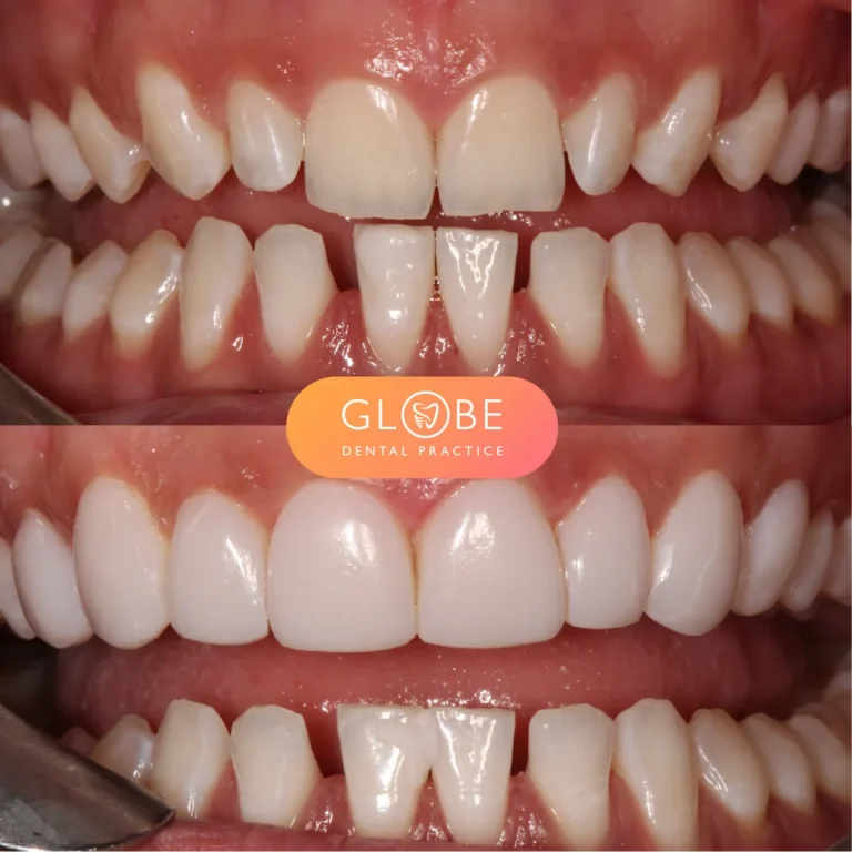 before-and-afters-12